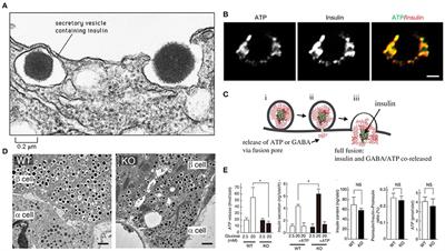 Commentary: ATP: The crucial component of secretory vesicles: Accelerated ATP/insulin exocytosis and prediabetes